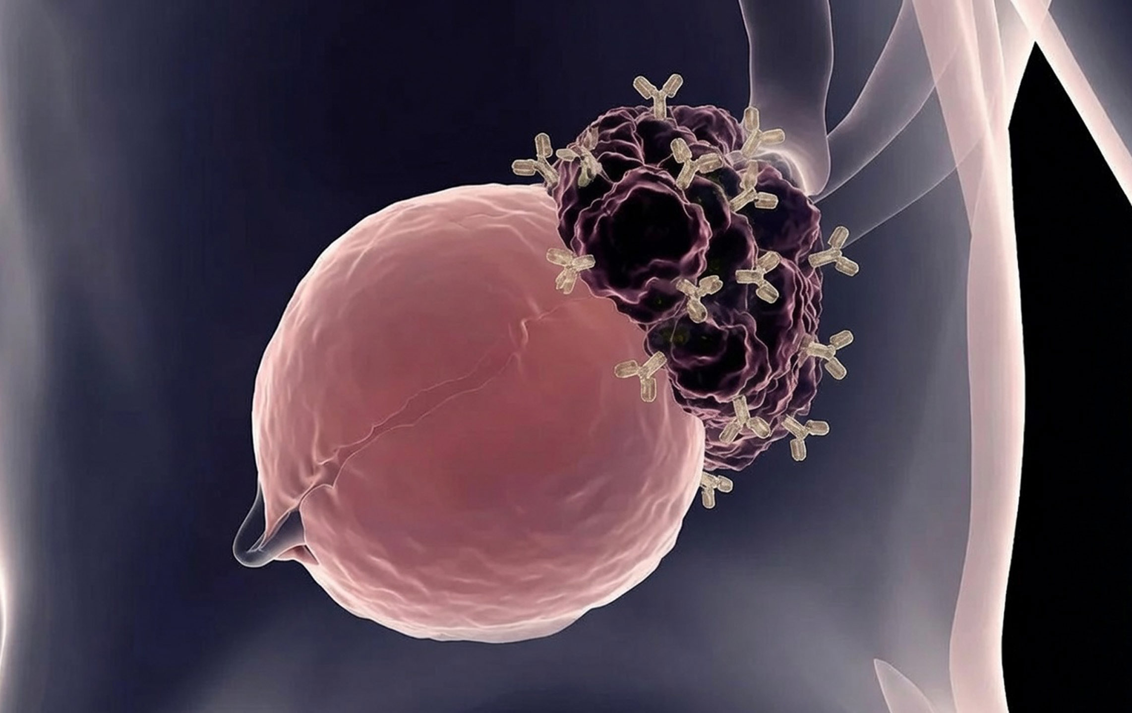 3D rendering of Antibodies attaching to ovarian cancer
