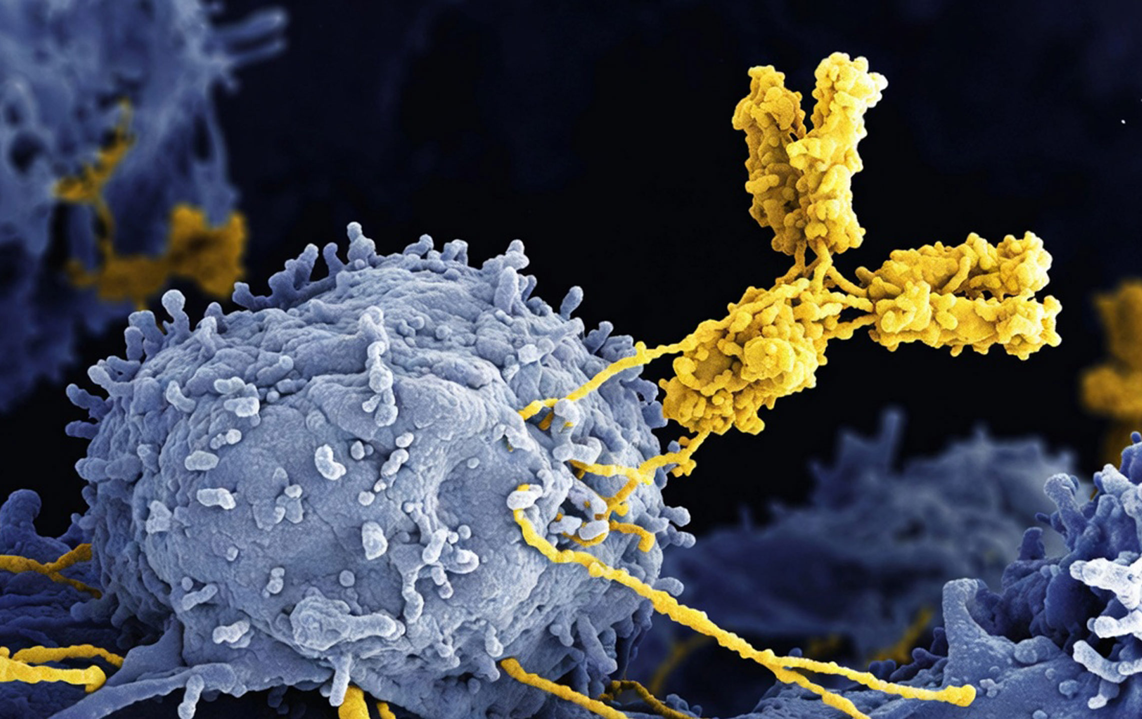 3D rendering of Antibody in a biological environment